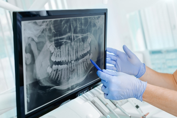 Common Periodontal Issues A Dentist Can Identify Early And Treat