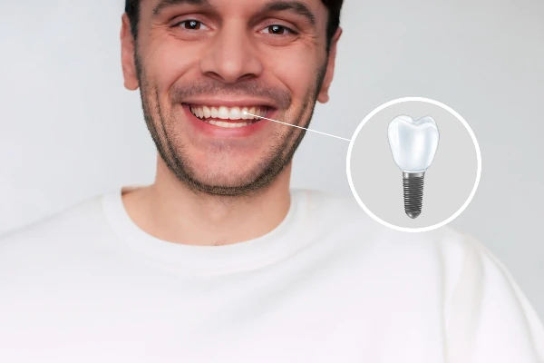 Dental Implants vs. Other Tooth Replacement Options from North Georgia Smiles in Cumming, GA