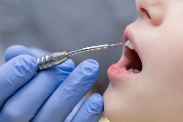 How Laser Dentistry Improves Comfort And Healing Time